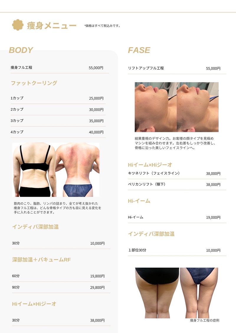 エステメニュー