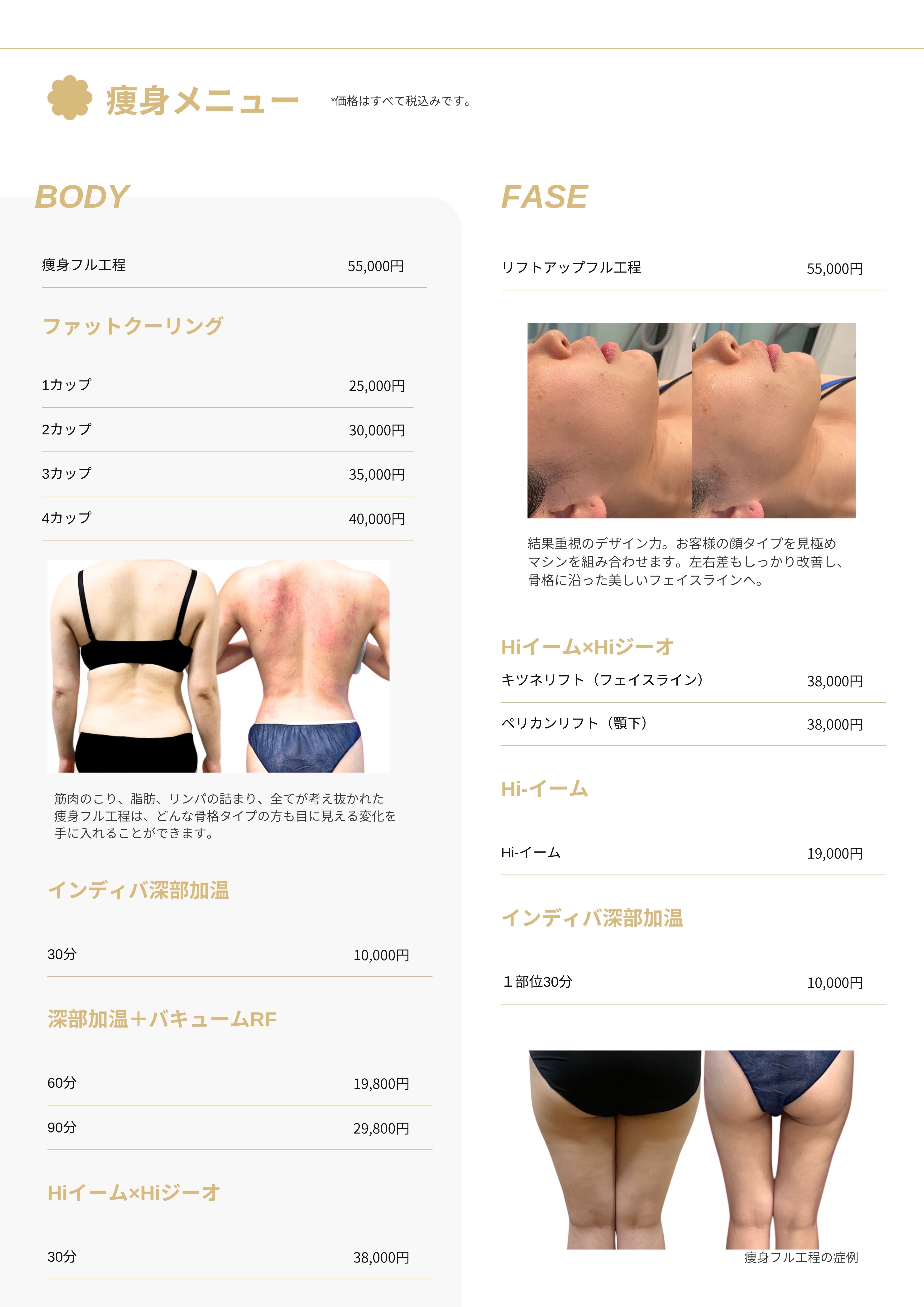 エステメニュー