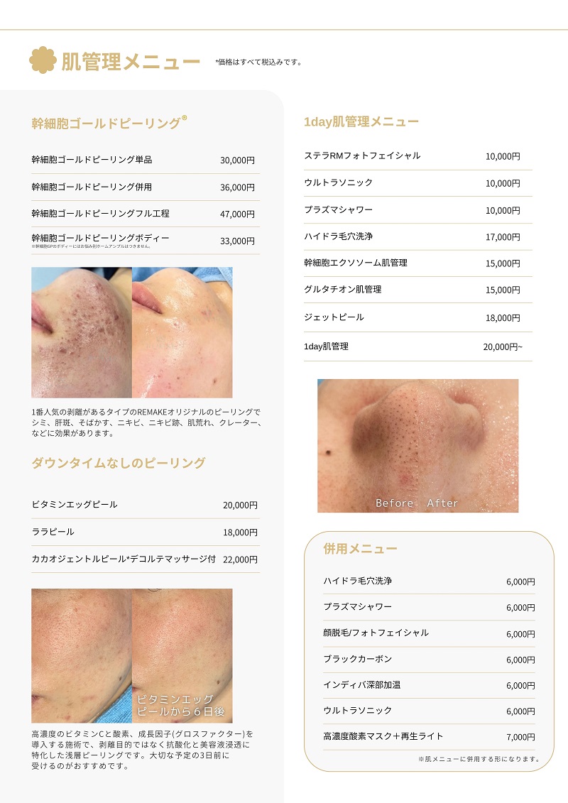 エステメニュー