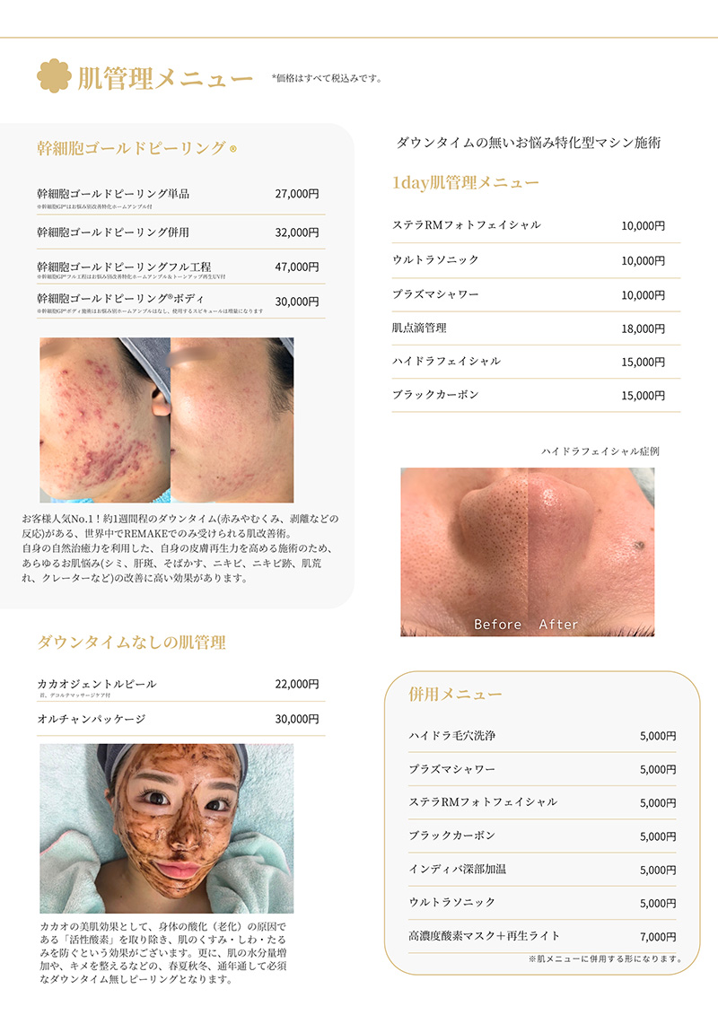 エステメニュー