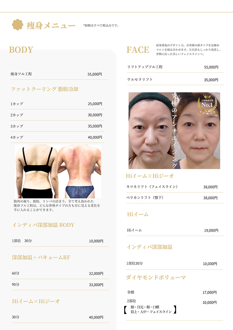 エステメニュー