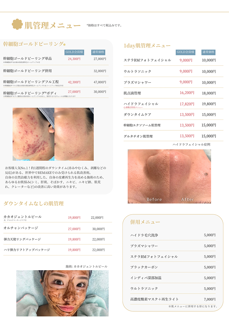 エステメニュー