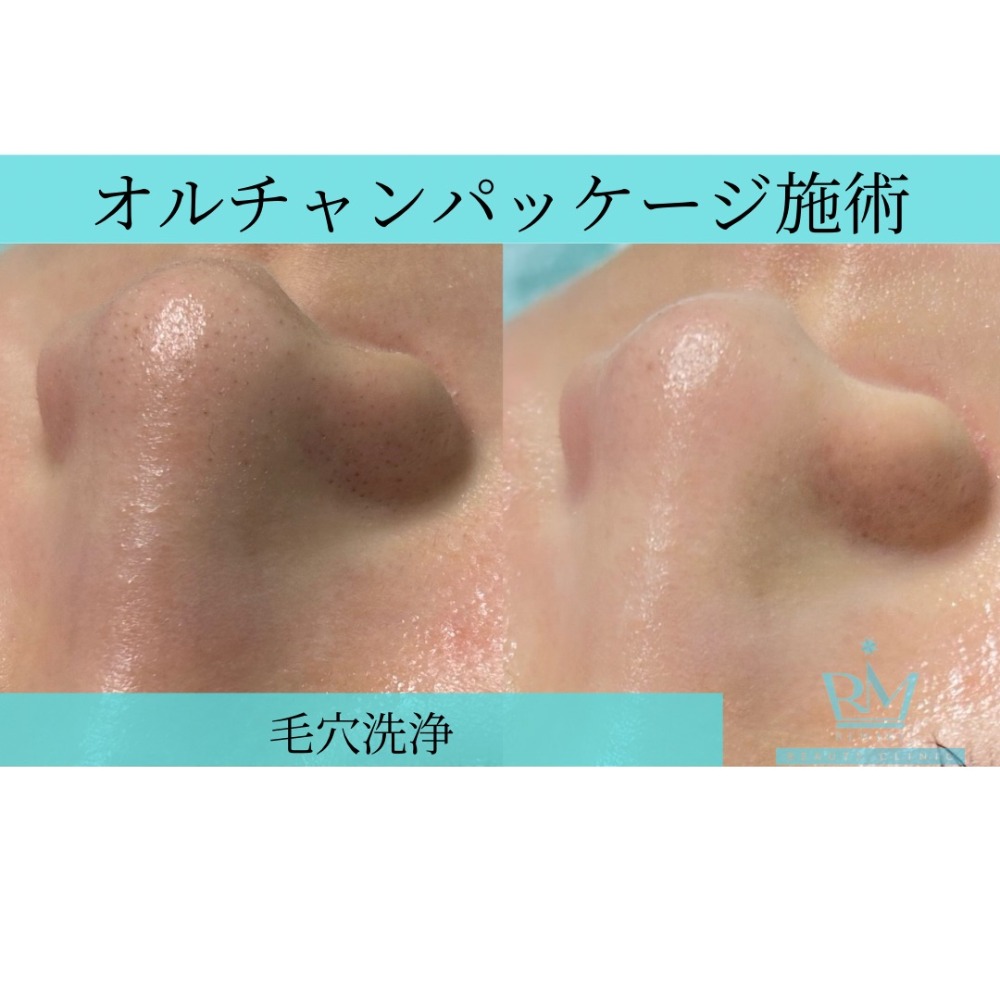 ダウンタイムなし